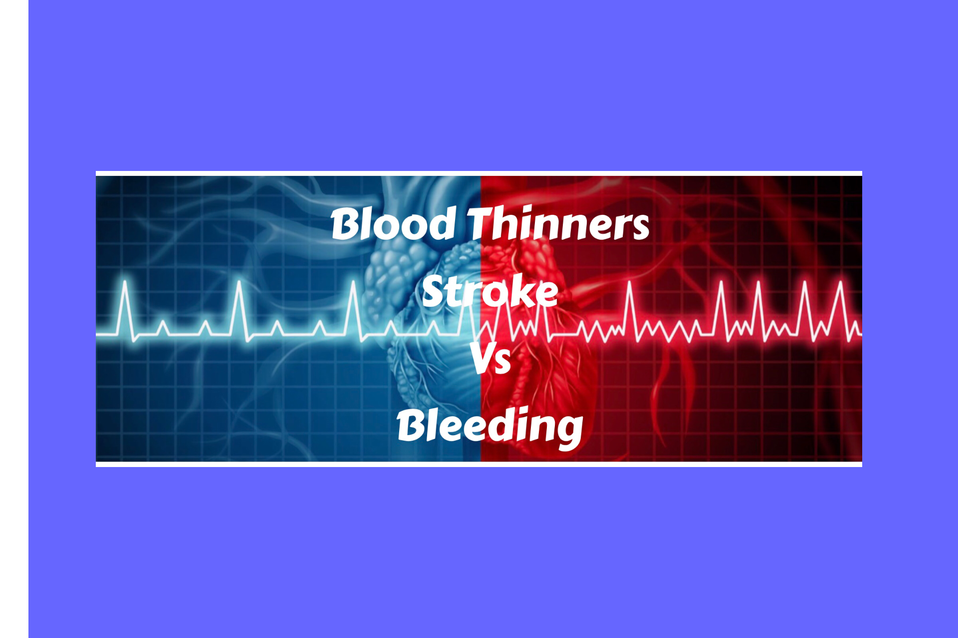 Blood Thinners – Risk Of Stroke Vs Risk Of Bleeding In Atrial ...